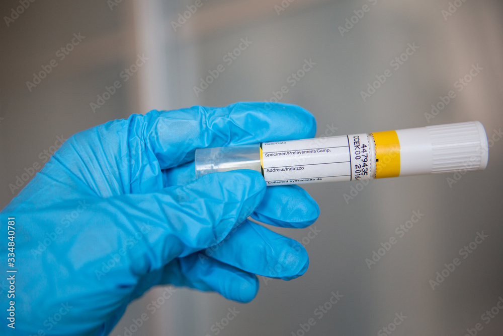 Naklejka premium Coronavirus - Epidemic Outbreak.