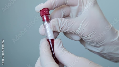 Hands In A Disposable Laboratory Gloves close down A Test Tube With Blood