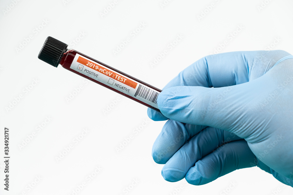 Obraz premium Test tube with blood sample in lab for COVID-19 test in hand of doctor wear blue glove, laboratory sample of blood testing for diagnosis new Corona virus infection, the pandemic infectious concept