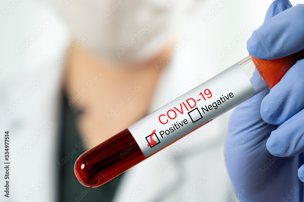 Woman doctor holding a blood test tube which is signed as covid-19 positive.