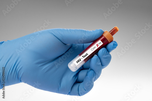 Blood test, HIV, AIDS test - test sample tube