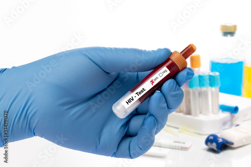 Blood test  HIV  AIDS test - test sample tube