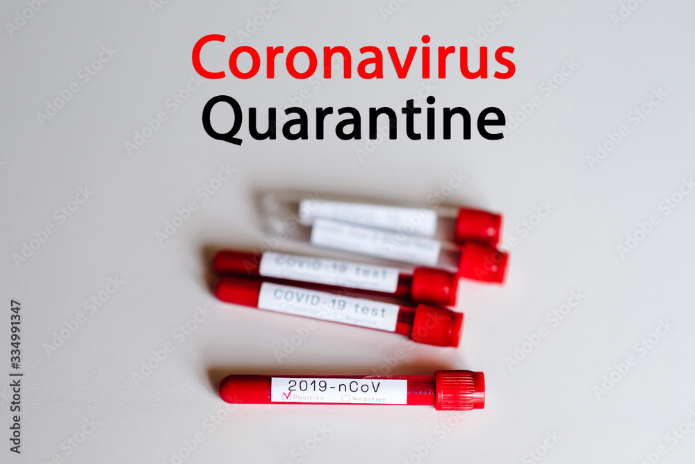 Obraz premium Coronavirus quarantine text. Biological blood samples in test tubes lie on a white background. 2019-nCov. Conduct laboratory test - positive result. Blood is infected. New cases of infection. Updates.