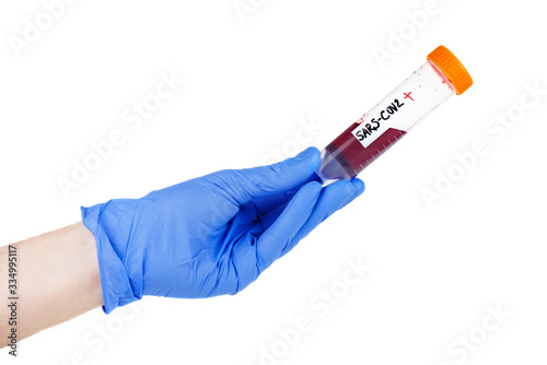 Hand hold plastic test tube with blood on a white background