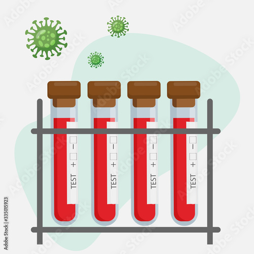 Test tubes with blood. Tests for determining viruses in the blood. Flat vector illustration.