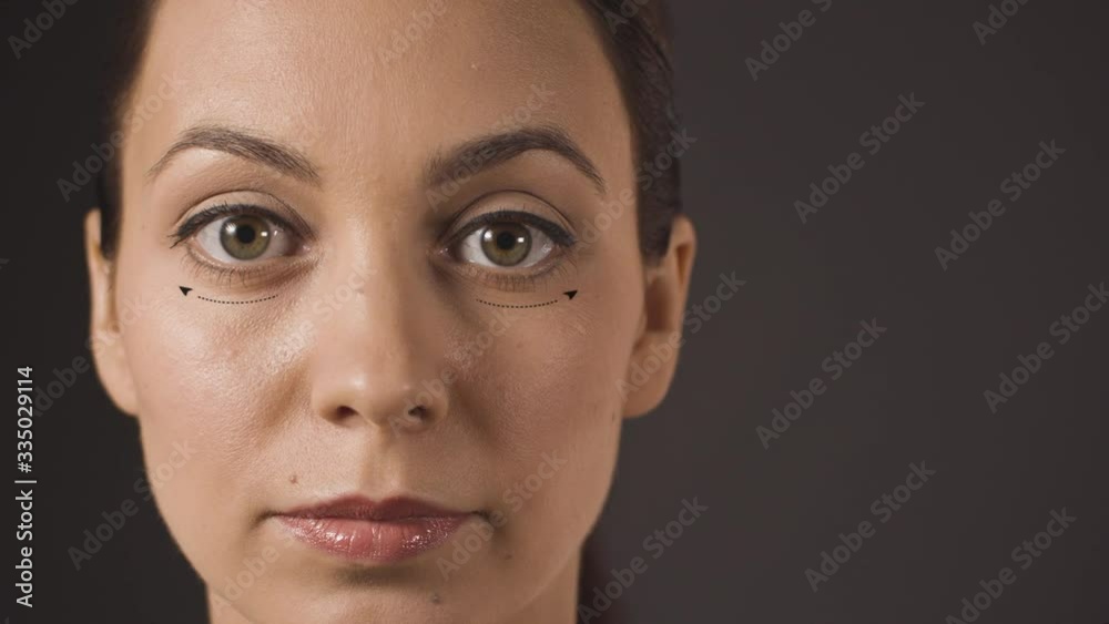 black lines on woman face showing derections of facelift facial massage black lines on woman face showing derections of facelift facial massage