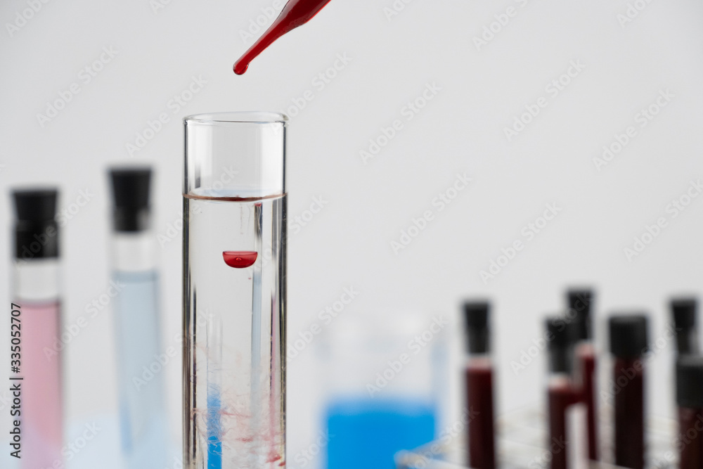 Clear Lab Sample Clear science liquid in test tube with blood sample from pipette ...