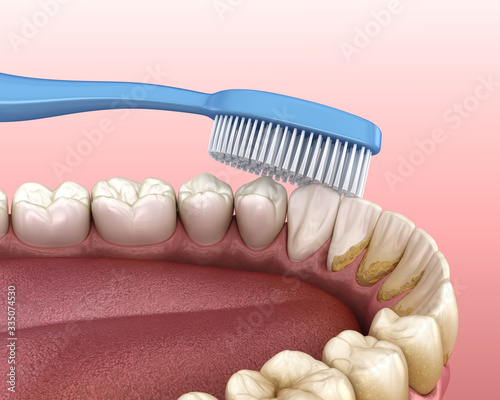 Toothbrush cleaning teeth. Medically accurate 3D illustration of oral hygiene.