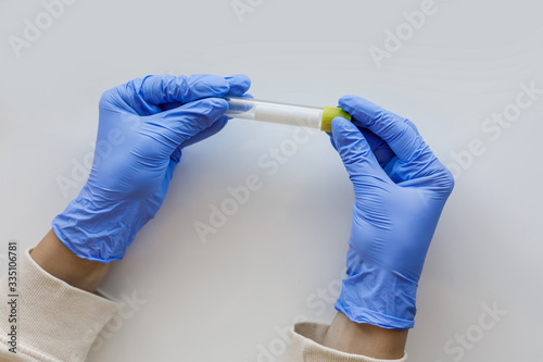 hands in blue medical gloves hold a flask for virus tests
