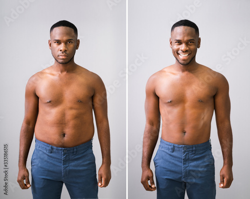 Bild auf Leinwand Man Before And After Weight Loss