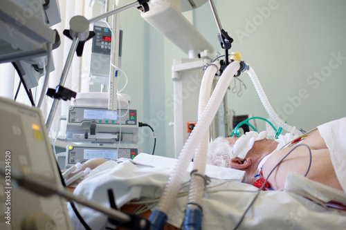 Coronavirus pandemic. Patient with coronavirus pneumonia in critical state. Intubated senior under ventilator lying in coma in intensive care department. photo