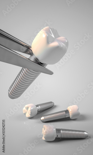 Dental implants with tweezers and white background illustration