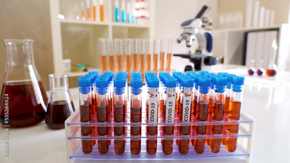 28027_View_inside_the_laboratory_with_the_coronavirus_samples.mov 28027_View_inside_the_laboratory_with_the_coronavirus_samples.mov
