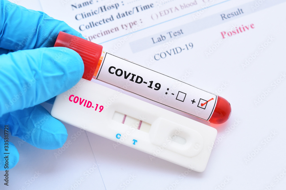 Obraz premium Positive test result by using rapid test device for COVID-19 virus