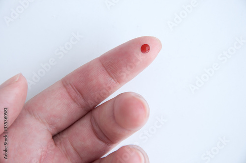 Photography Pin prick test