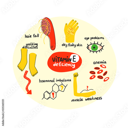 Hand drawn vitamin E tocopherol deficiency: hair loss, eyeproblem, anemia, muscle weakness, hormonal imbalance. Vector illustration is for pharmalogical or medical poster, brochure.