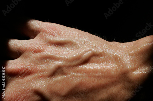 dorsal of a sweaty hand with many veins on a black background
