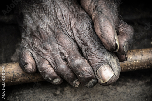 Close-up photograph of the feet of an elderly homeless woman from India.