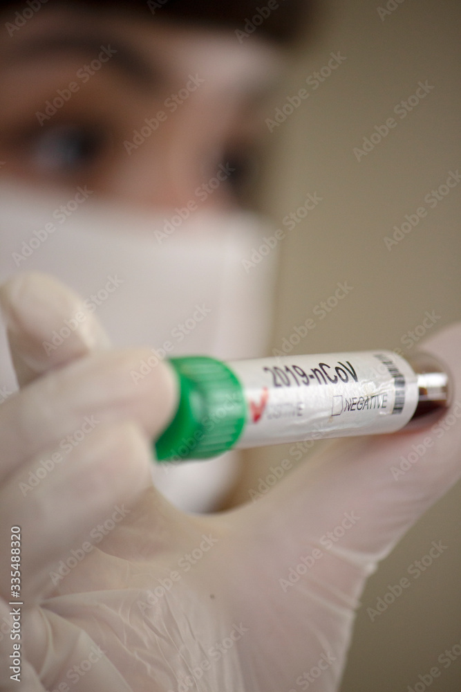 A woman doctor holds a positive coronavirus test tube in her hand. Positive covid-19 test tube. A woman doctor holds a positive coronavirus test tube in her hand. Positive covid-19 test tube.