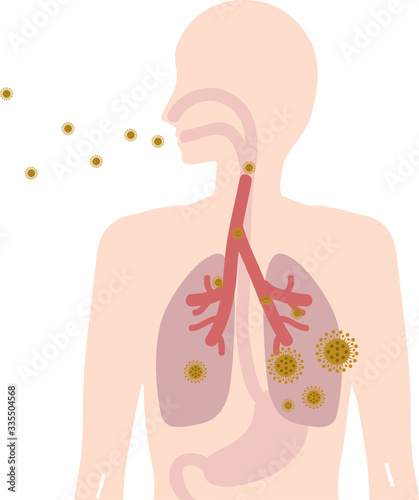 ウイルスを吸収・咳をしているイメージ