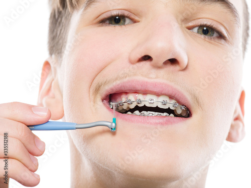 Teen boy cleaning braces. Young man taking care of his teeth. Dental hygiene. Teenager brushes braces.