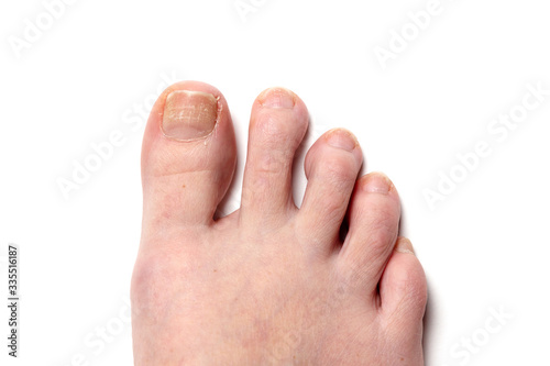 female toenails without pedicure