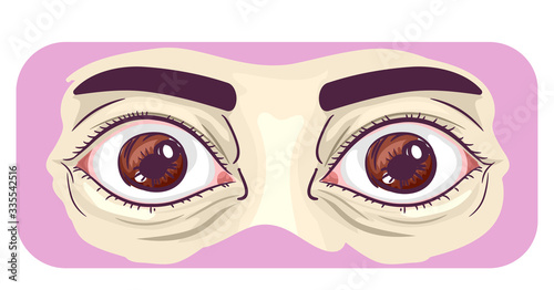 Symptom Bulging Eyes Illustration