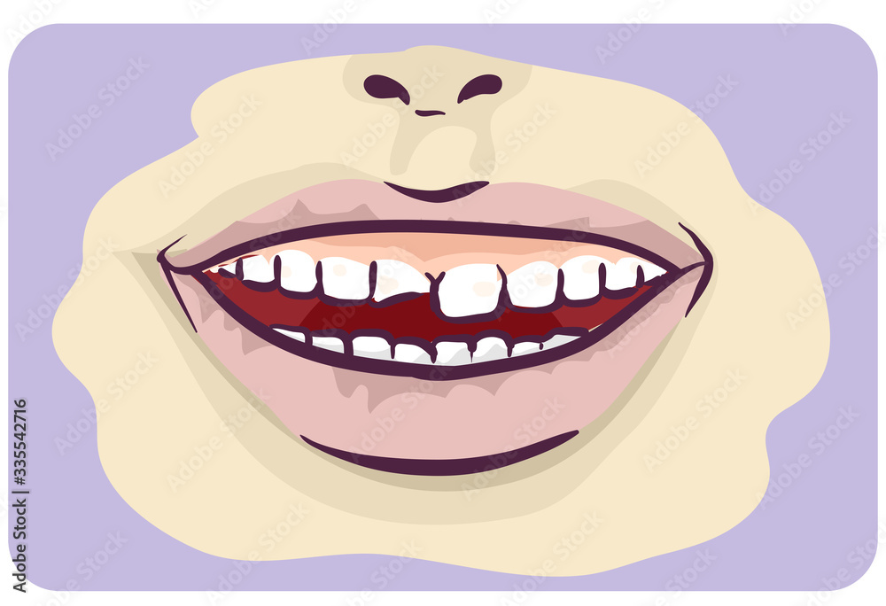 Naklejka premium Symptoms Chipped Tooth Illustration