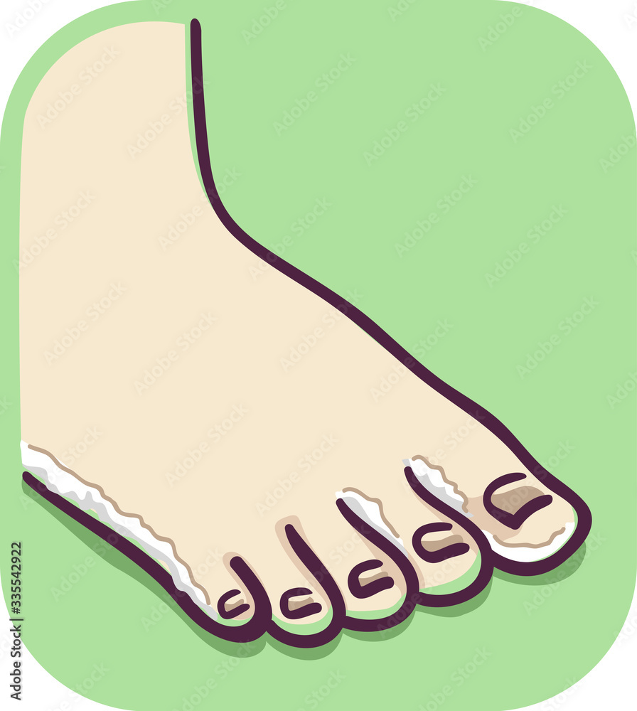 Fototapeta premium Feet Flaky Skin Illustration