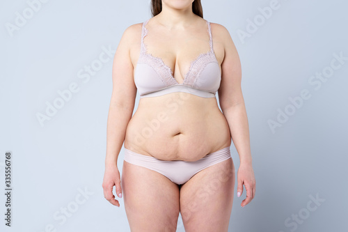 Tummy tuck, flabby skin on a fat belly, plastic surgery concept