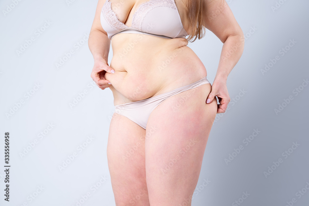 Tummy tuck, flabby skin on a fat belly, plastic surgery concept - obrazy, fototapety, plakaty 