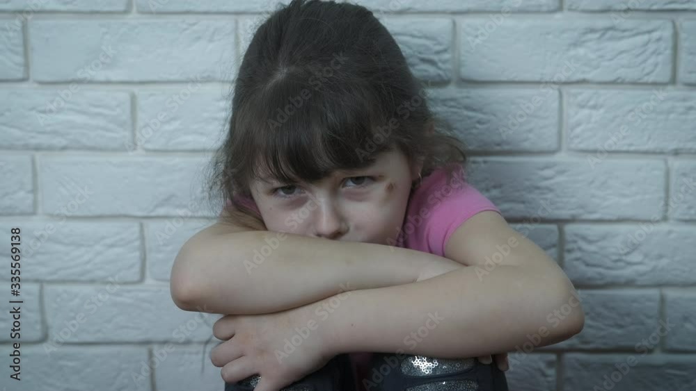 Child abuse. Frightened battered child. Child abuse. Frightened battered child.