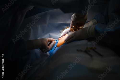 фотографія Breast tumor resection. Wound closure