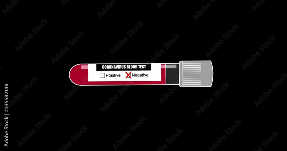 Negative Test of Coronavirus Covid-19 Animation Negative Test of Coronavirus Covid-19 Animation