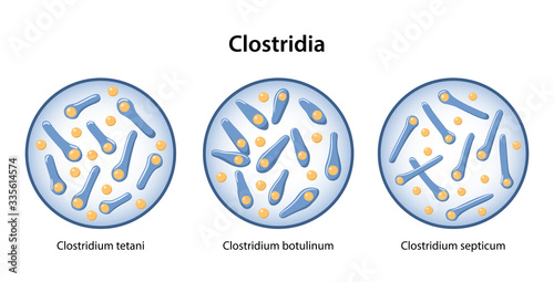 Clostridia. The figure shows three examples of clostridium bacillus: tetanus bacillus, botulism and Clostridium septicum. Vector illustration in flat style isolated over white background