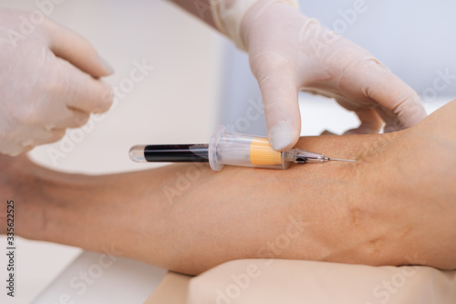 Close-up of doctor collects blood in a syringe. Nurse takes blood from the veins on the arm for biochemical blood testing. Concept of healthcare and medicine.