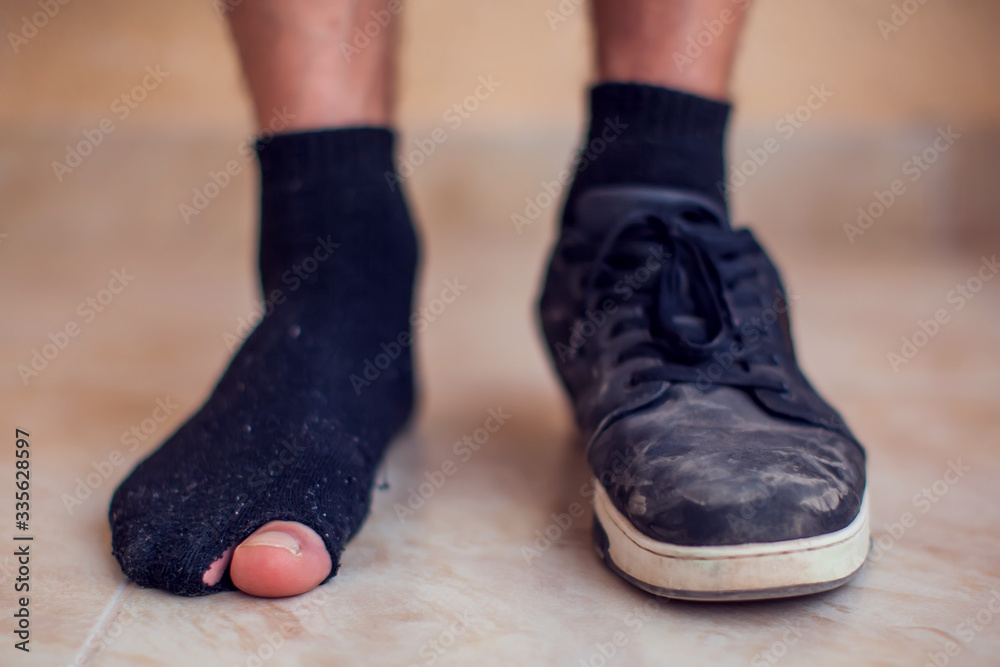 Man wearing holey sock and dirty shoes. Poorness and untidiness concept