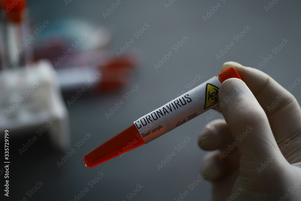 Obraz premium A blood sample for testing the dangerous virus coronavirus in the body. Test tubes with tests for coronavirus. Laboratory studies of viral diseases.