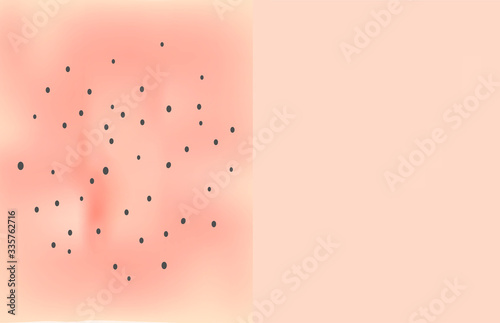 Skin texture with black dots of acne. Before After acne. Skin background. Infographics. Vector illustration