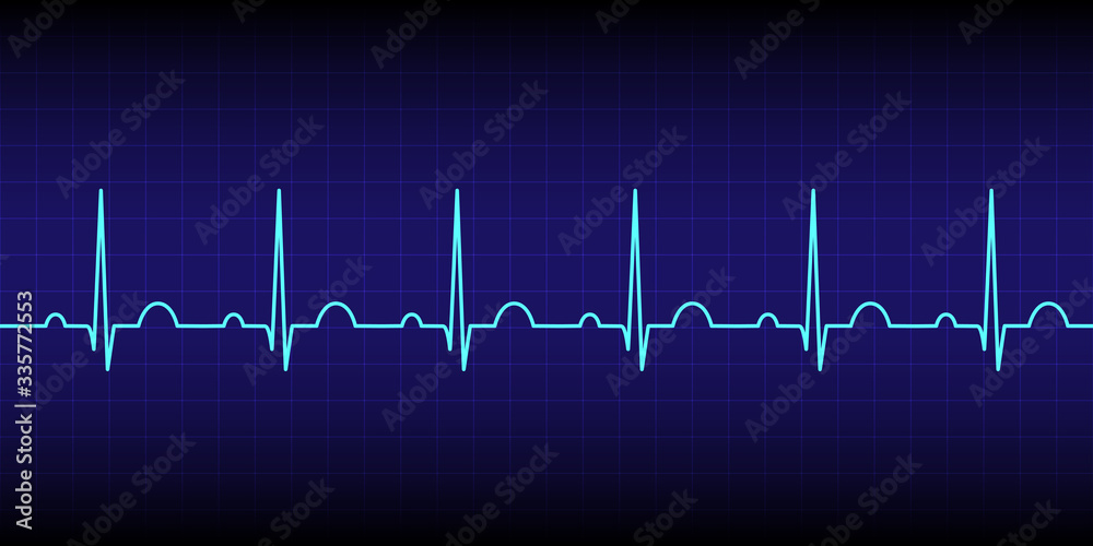 Electrocardiogram show normal heart beat line (Sinus rhythm) isolated on dark blue background.Vital sign.Medical healthcare concept.Vector.Illustration.