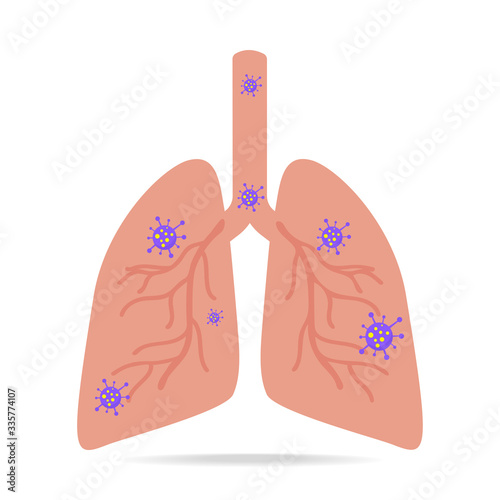 Virus and bacteria infected the human lungs illustration