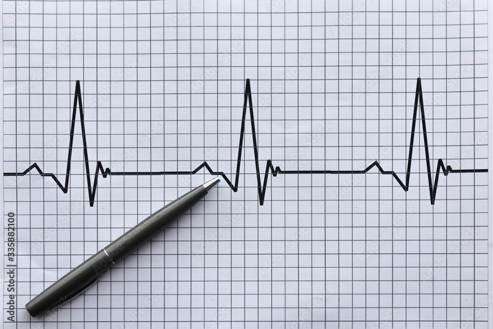 Business chart and pen. Pulse and business. Business concept pen and chart. Business chart and pen. Pulse and business. Business concept pen and chart.