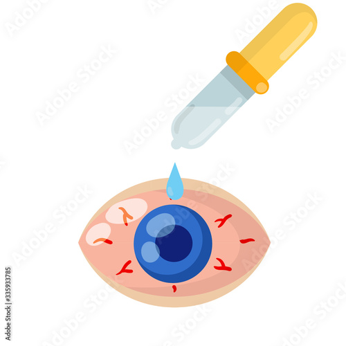 Pipette and eyedropper. Red eye disease. Medicine for blood vessels and Allergy Problems. Conjunctivitis and health. Flat Drop of water. Blue human pupil