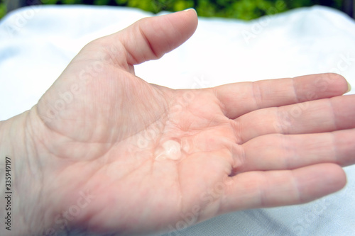 alcohol gel in caucasian hand