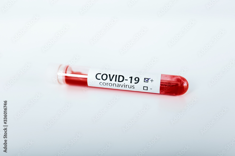 Test tube with blood sample for COVID-19 test, novel coronavirus 2019 found in Wuhan, China Test tube with blood sample for COVID-19 test, novel coronavirus 2019 found in Wuhan, China