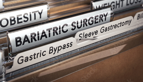 Bariatric Surgery Types, Gastric Bypass Or Sleeve Gastrectomy.