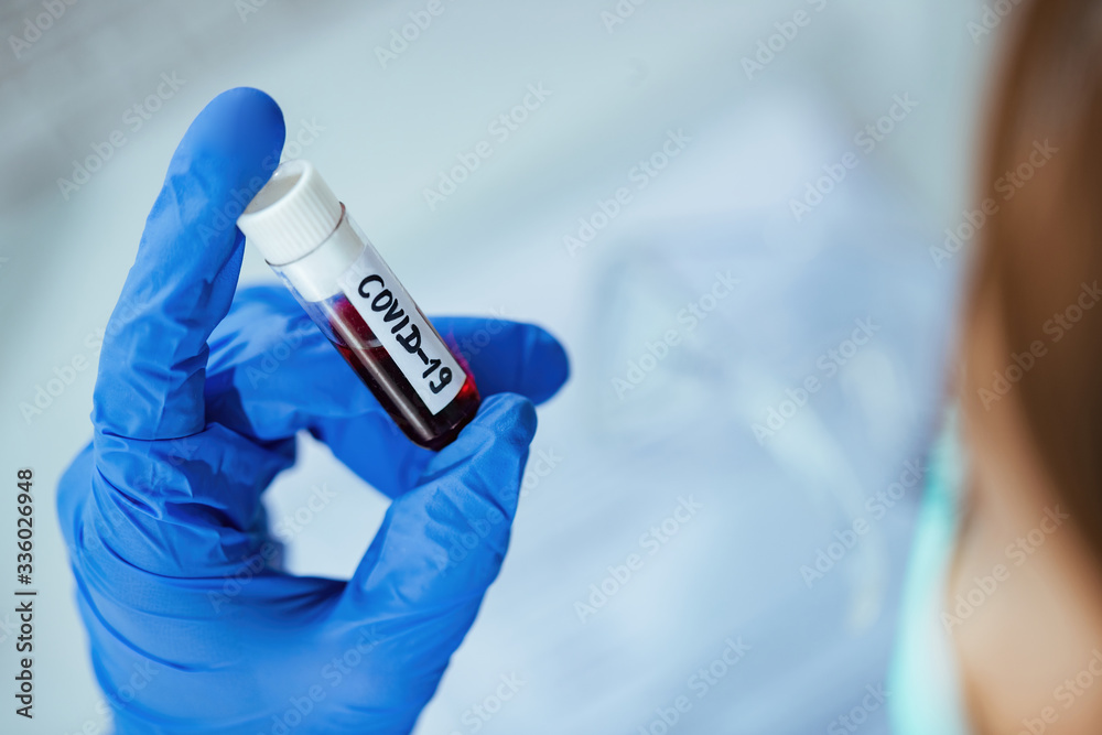 Close-up of lab technician holding flask with coronavirus blood sample.