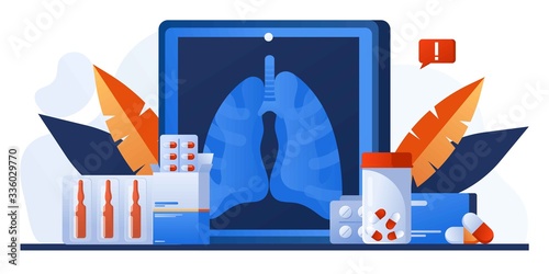 Examination patients lungs with tuberculosis, lung cancer, asthma diseases, coronavirus, infection. Pulmonology or respiratory medicine. Pharmacy, drugs and pills. Chest x-ray. Lung radiography image