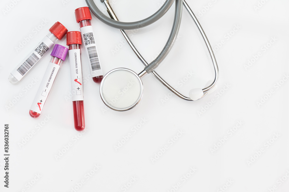 Top view blood test tube has tested negative and positive for coronavirus (COVID-19) on white background.Different blood test tube and stethoscope.Laboratory medical concept. Top view blood test tube has tested negative and positive for coronavirus (COVID-19) on white background.Different blood test tube and stethoscope.Laboratory medical concept.