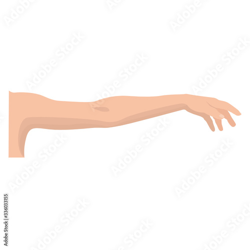 Arm